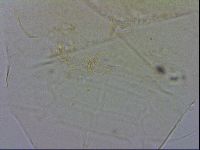 Echiniscus testudo image