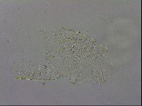 Echiniscus testudo image