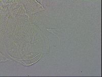 Echiniscus testudo image