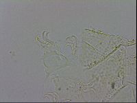 Echiniscus testudo image