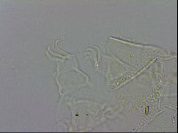 Echiniscus testudo image