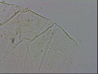 Echiniscus testudo image