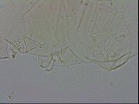 Echiniscus testudo image