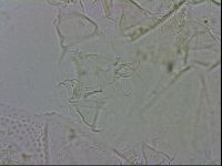 Echiniscus testudo image