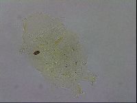Echiniscus testudo image