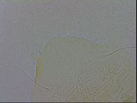 Echiniscus testudo image