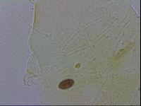 Echiniscus testudo image