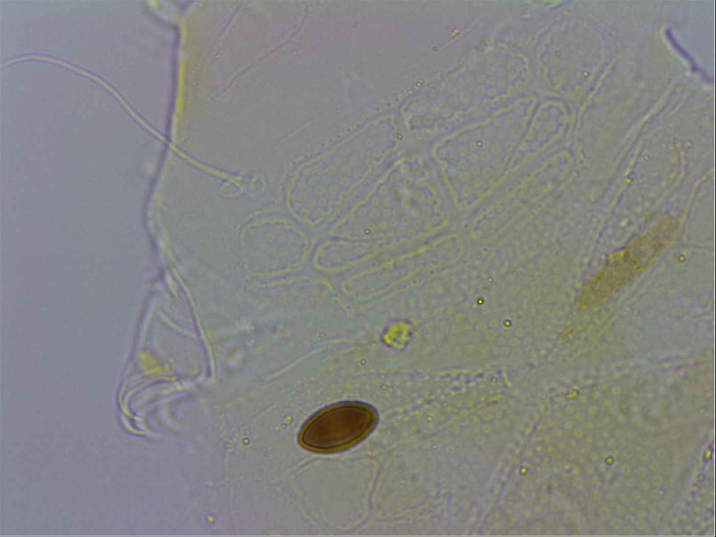 Echiniscus testudo image
