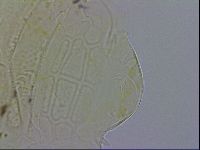 Echiniscus testudo image