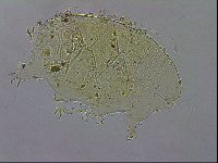 Echiniscus testudo image