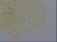 Echiniscus testudo image