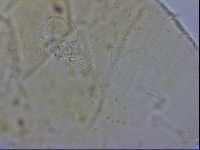 Echiniscus testudo image