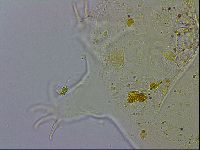 Echiniscus testudo image
