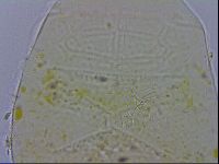 Echiniscus testudo image