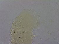 Echiniscus testudo image