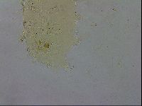Echiniscus testudo image