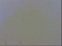 Echiniscus testudo image