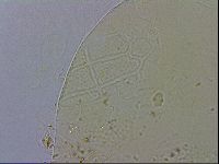 Echiniscus testudo image