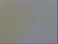 Echiniscus testudo image