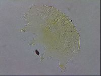 Echiniscus testudo image
