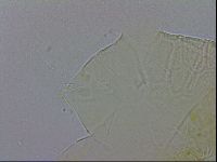 Echiniscus testudo image