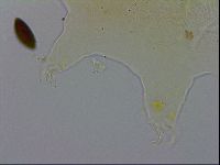 Echiniscus testudo image