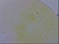 Echiniscus testudo image