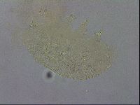Echiniscus testudo image