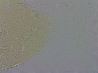 Echiniscus testudo image