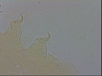 Echiniscus testudo image