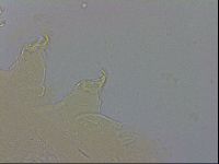 Echiniscus testudo image