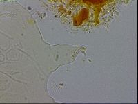 Echiniscus testudo image
