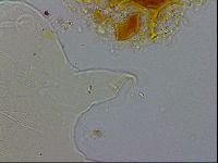 Echiniscus testudo image