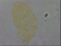 Echiniscus testudo image