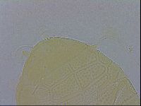 Echiniscus testudo image