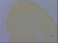 Echiniscus testudo image