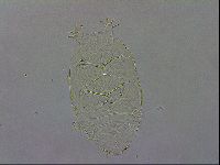 Echiniscus testudo image