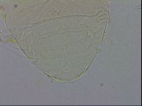 Echiniscus testudo image