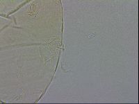 Echiniscus testudo image