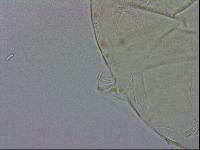 Echiniscus testudo image