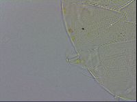 Echiniscus testudo image