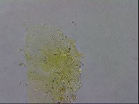 Echiniscus testudo image