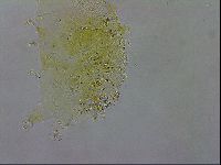 Echiniscus testudo image