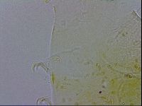 Echiniscus testudo image