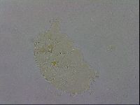 Echiniscus testudo image