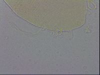 Echiniscus testudo image