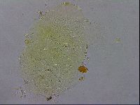 Echiniscus testudo image