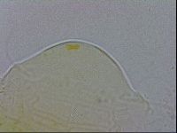 Echiniscus testudo image