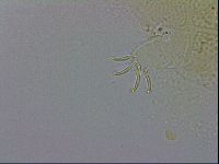 Echiniscus testudo image