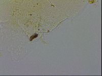 Echiniscus testudo image